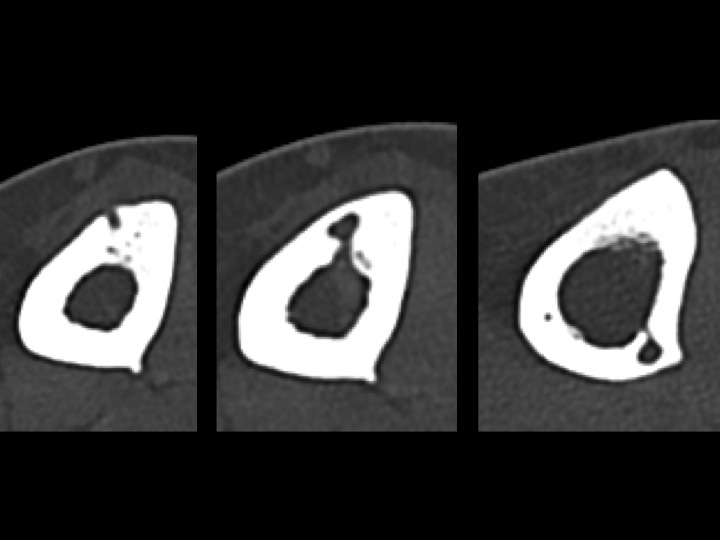 Figure 2 for case varix ( RID3366 )